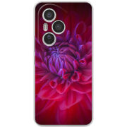 Чохол BoxFace Honor 400 Pro 