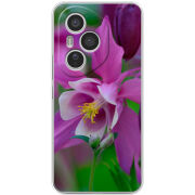 Чохол BoxFace Honor 400 Pro 