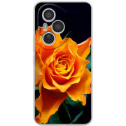 Чохол BoxFace Honor 400 Pro 