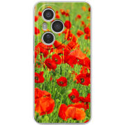 Чохол BoxFace Honor 400 Pro 