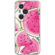 Чохол BoxFace Honor 400 Pro 