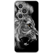 Чохол BoxFace Honor 400 Pro 