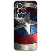 Чохол BoxFace Honor 400 Pro 