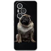 Чохол BoxFace Honor 400 Pro 