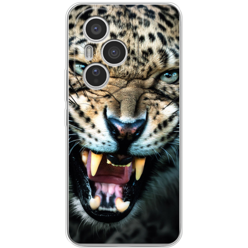 Чохол BoxFace Honor 400 Pro 