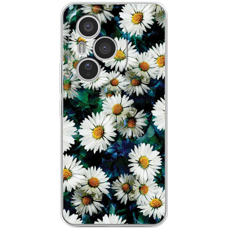 Чохол BoxFace Honor 400 Pro 