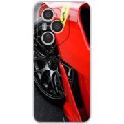 Чохол BoxFace Honor 400 Pro Ferrari 599XX