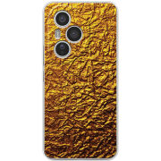 Чохол BoxFace Honor 400 Pro 