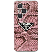 Чохол BoxFace Honor 400 Pro 