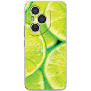 Чохол BoxFace Honor 400 Pro 