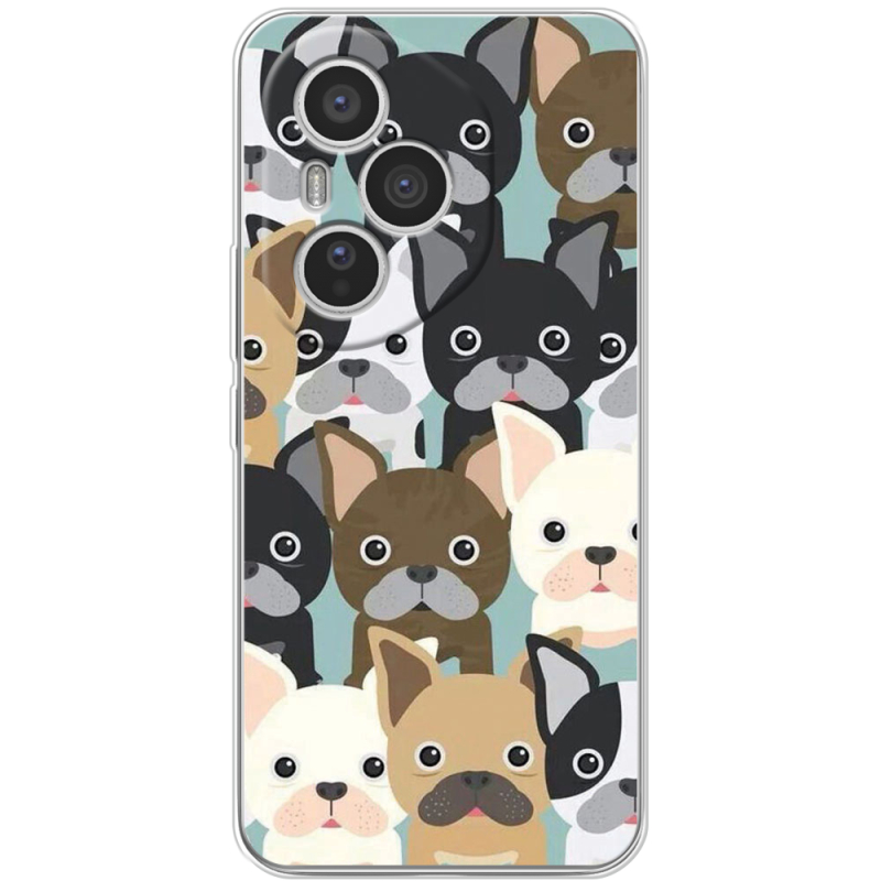 Чохол BoxFace Honor 400 Pro 