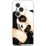 Чохол BoxFace Honor 400 Pro 