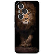 Чохол BoxFace Honor 400 Pro 