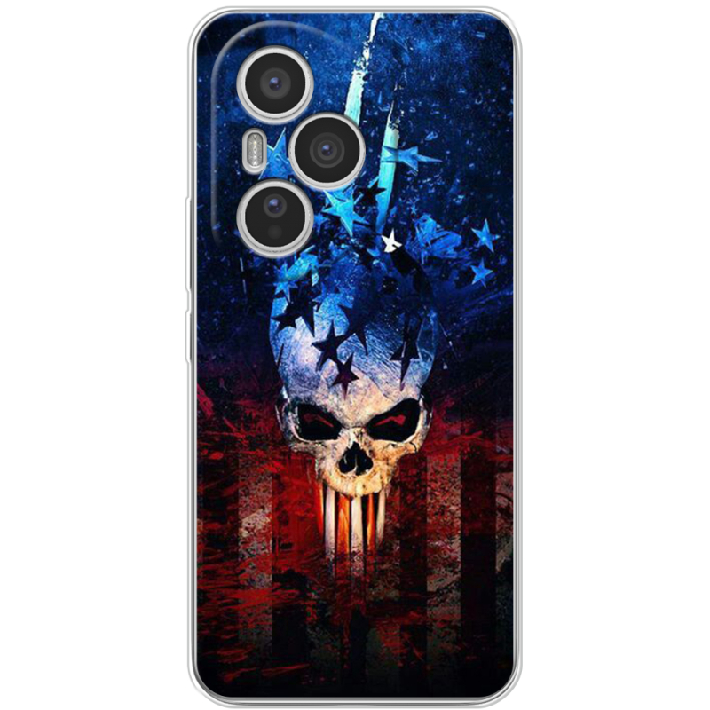 Чохол BoxFace Honor 400 Pro 