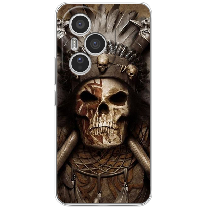 Чохол BoxFace Honor 400 Pro 