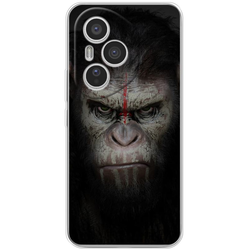 Чохол BoxFace Honor 400 Pro 