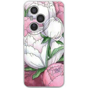 Чохол BoxFace Honor 400 Pro 