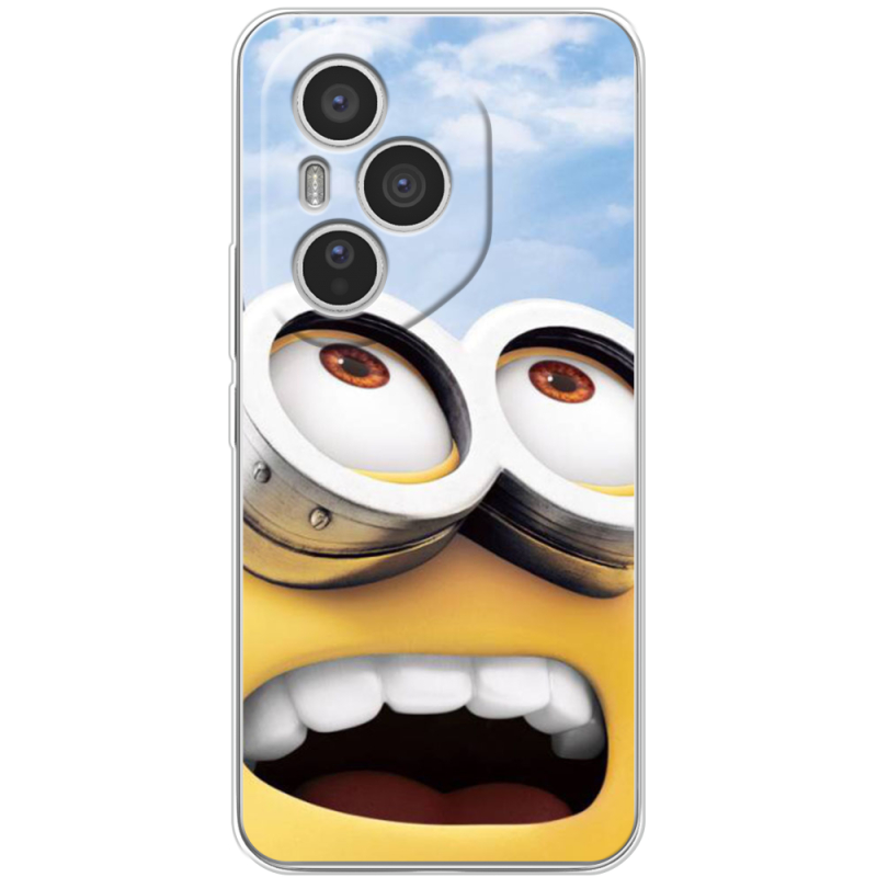 Чохол BoxFace Honor 400 Pro 