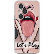 Чохол BoxFace Honor 400 Pro 