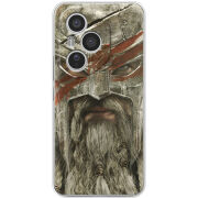 Чохол BoxFace Honor 400 Pro 