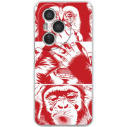 Чохол BoxFace Honor 400 Pro 