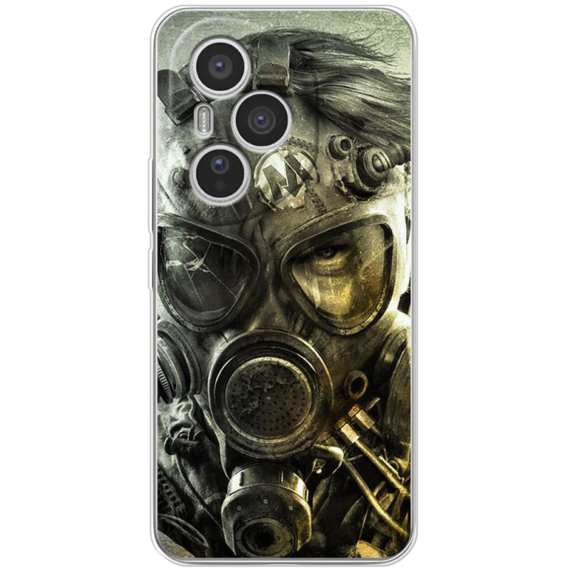 Чохол BoxFace Honor 400 Pro 