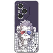 Чохол BoxFace Honor 400 Pro 