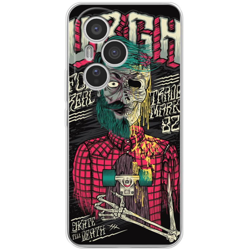 Чохол BoxFace Honor 400 Pro 