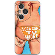 Чохол BoxFace Honor 400 Pro 