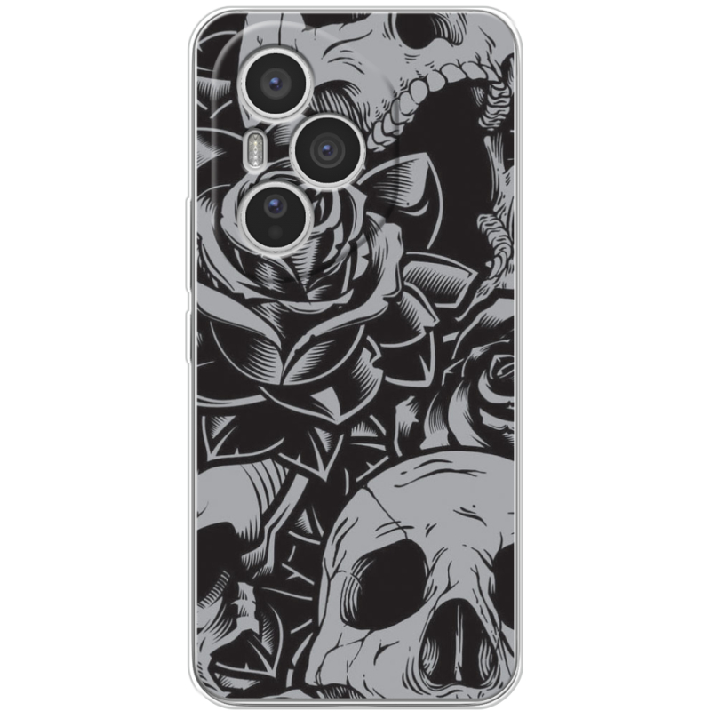 Чохол BoxFace Honor 400 Pro 