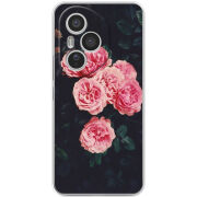 Чохол BoxFace Honor 400 Pro 