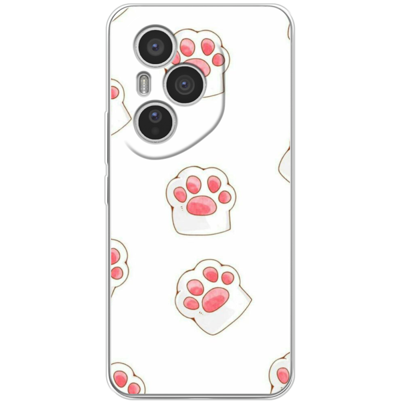 Чохол BoxFace Honor 400 Pro 