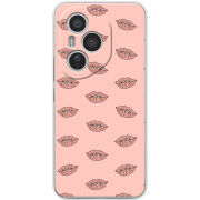 Чохол BoxFace Honor 400 Pro 