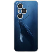 Чохол BoxFace Honor 400 Pro 