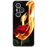 Чохол BoxFace Honor 400 Pro 