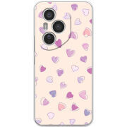 Чохол BoxFace Honor 400 Pro 