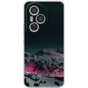 Чохол BoxFace Honor 400 Pro 