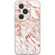 Чохол BoxFace Honor 400 Pro 