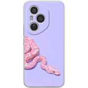 Чохол BoxFace Honor 400 Pro 