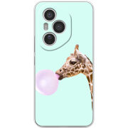 Чохол BoxFace Honor 400 Pro 