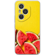 Чохол BoxFace Honor 400 Pro 