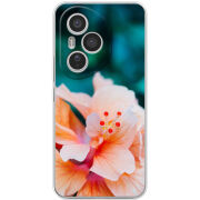 Чохол BoxFace Honor 400 Pro 