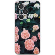 Чохол BoxFace Honor 400 Pro 