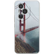 Чохол BoxFace Honor 400 Pro 