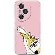 Чохол BoxFace Honor 400 Pro 