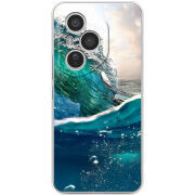 Чохол BoxFace Honor 400 Pro 