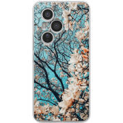 Чохол BoxFace Honor 400 Pro 