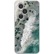 Чохол BoxFace Honor 400 Pro 