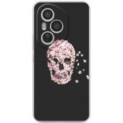 Чохол BoxFace Honor 400 Pro 