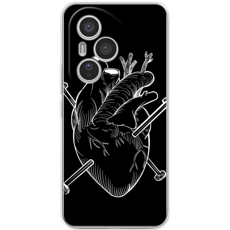 Чохол BoxFace Honor 400 Pro 